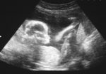 Bill could lead to more ultrasounds, fewer abortions
