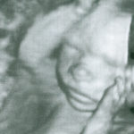 Unborn children ‘missing’ from Women’s March